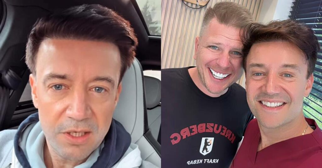 Filip Chajzer bonding afera zęby